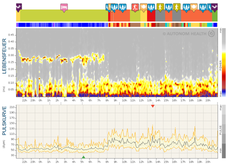 24h-Herzratenvariabilitätsmessung (HRV) inkl. einstündigem Gesundheitscoaching beim OTS Trailrun Camp 2025